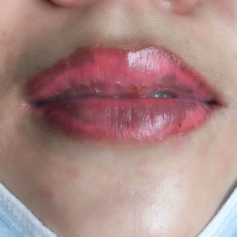 Màu môi loang lổ, không đều màu sau 1 tháng phun xăm là biểu hiện môi bị hỏng